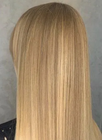 Tatyana, Hair Restoration