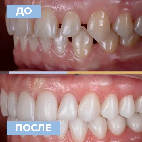 Dr. Sidiropylo Feona — СОВРЕМЕННАЯ ЕСТЕТИЧЕСКАЯ СТОМАТОЛОГИЯ! ПО ПРОМОКОДУ "BAZAR" получи скидку 10%