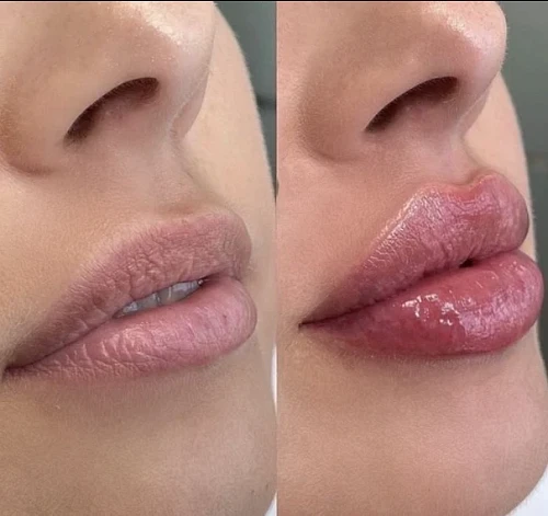 Aesthetics Cosmetology Services