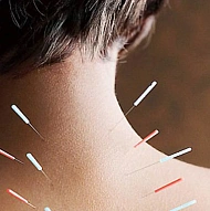 Art of Wellness Acupuncture Center