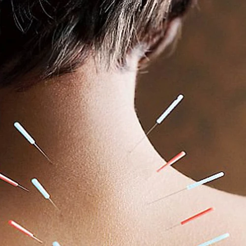 Art of Wellness Acupuncture Center