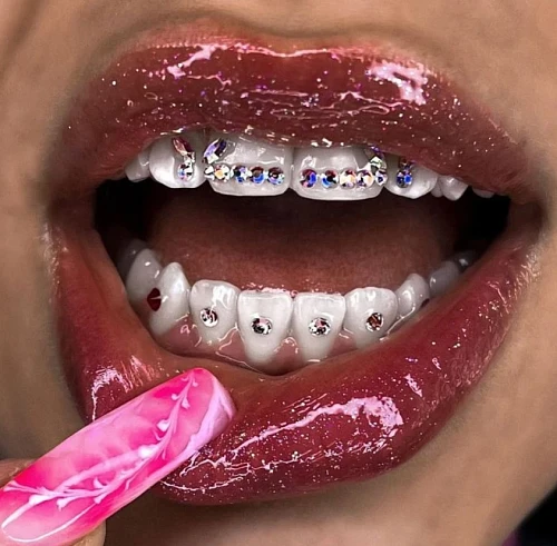 Tooth Gems