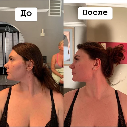 Elizabeth, Massage