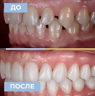 Dr. Sidiropylo Feona — СОВРЕМЕННАЯ ЕСТЕТИЧЕСКАЯ СТОМАТОЛОГИЯ! ПО ПРОМОКОДУ "BAZAR" получи скидку 10%