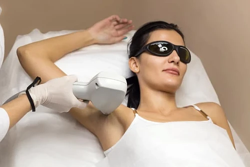 ABL Laser